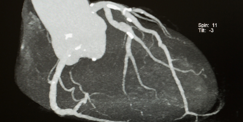 Cardiac Image